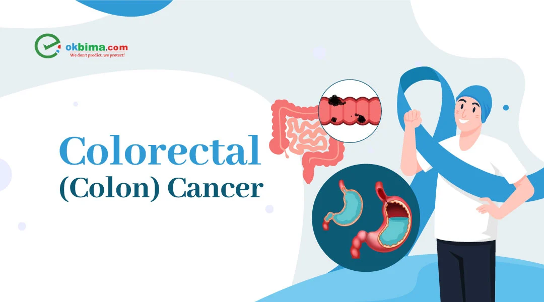 colorectal cancer